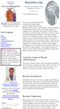 Mobile Screenshot of bursitis.org